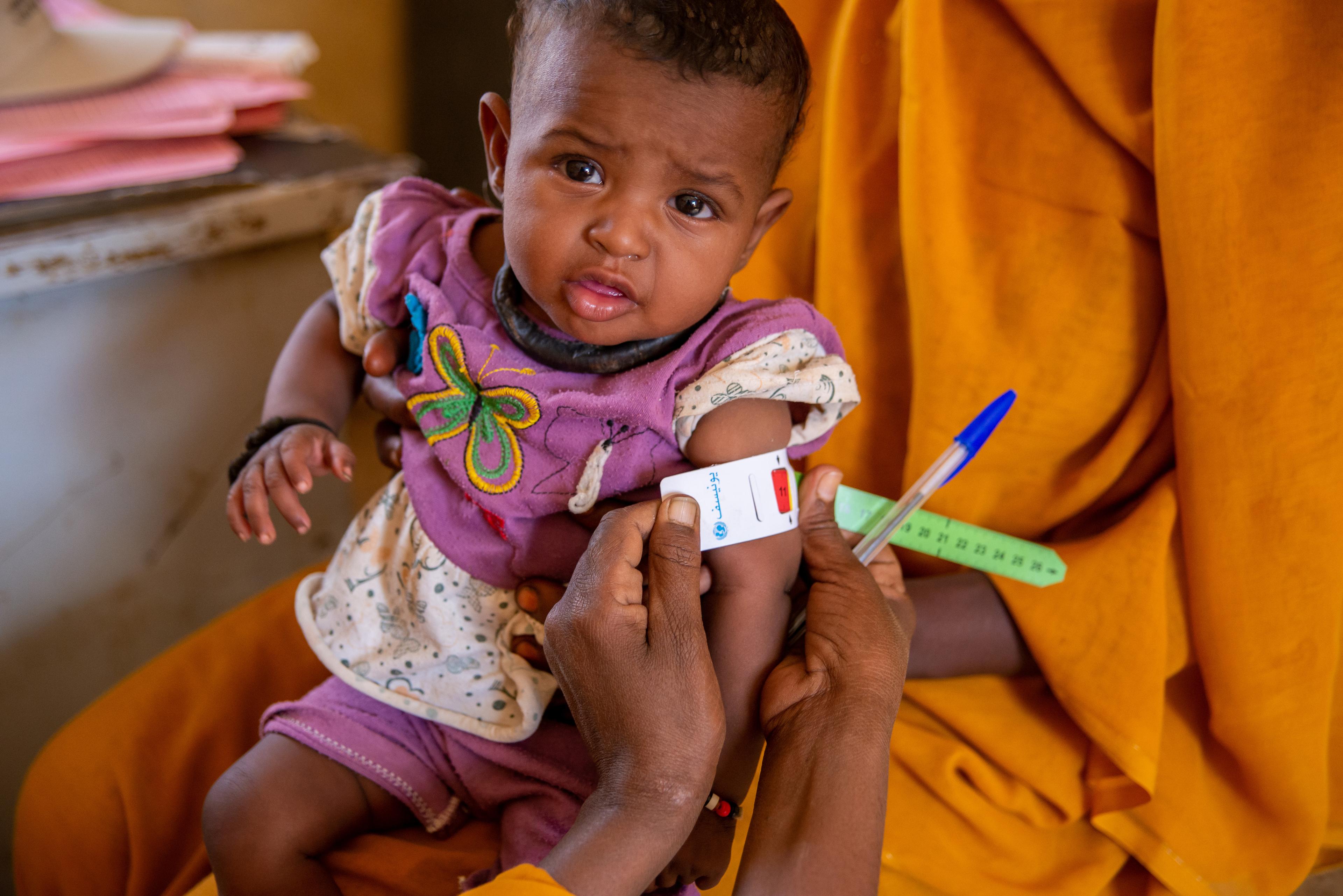 Baby Amnia uit Soedan is ondervoed en krijgt nu therapeutische voeding.